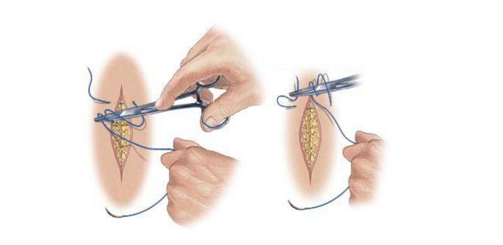 Lumps and Small Lesions